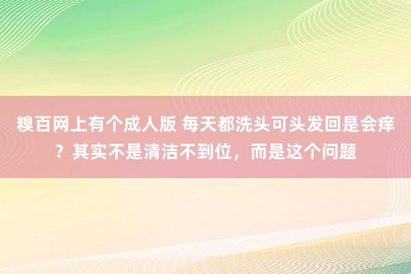 糗百网上有个成人版 每天都洗头可头发回是会痒？其实不是清洁不到位，而是这个问题